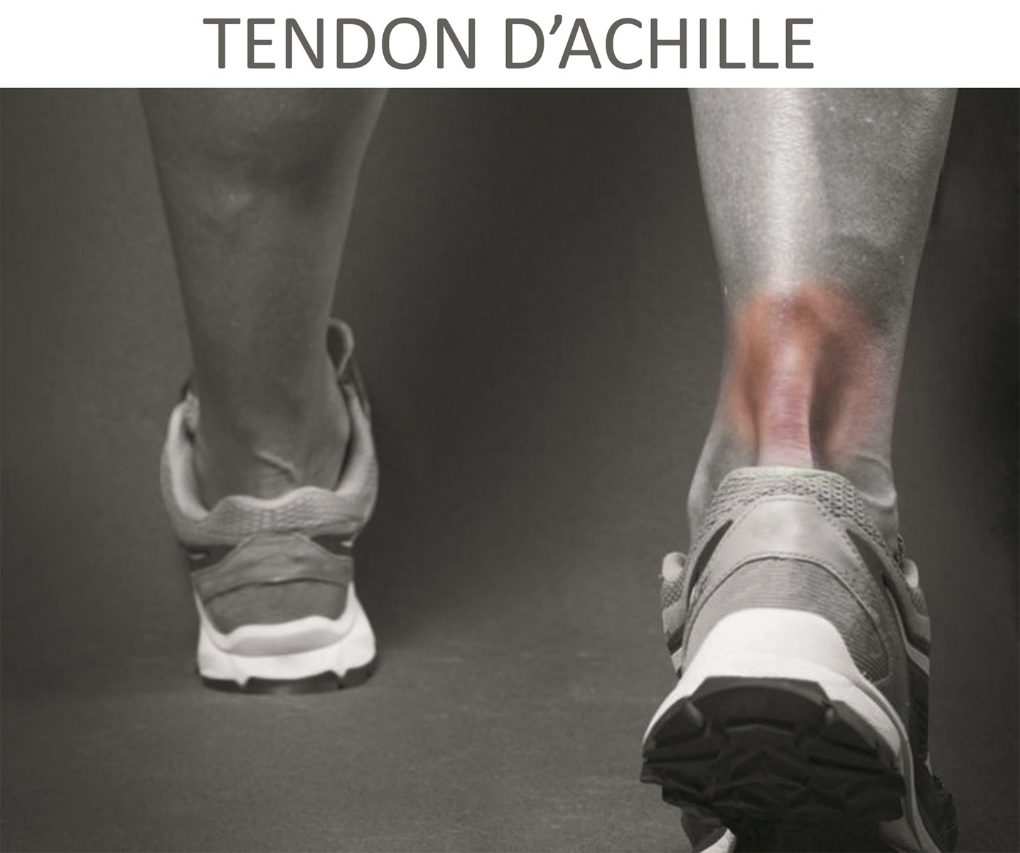 Tendon D'Achille